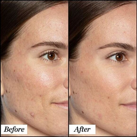 Sunday Riley Good Genes Lactic Acid Treatment - Picture 4 of 15